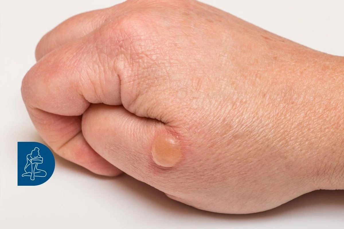 Come pulire il grasso bruciato dalla padella? Metodo casalingo senza chimica forte - image 1